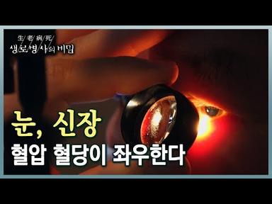 혈압, 혈당 관리 빨간불... 소혈관 질환이 당신의 눈과 신장을 위협한다 (KBS 20230308 방송)