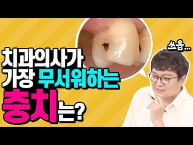 [납량특집] 치아사이 충치는 일단 대공사!! | 인접면충치 무서운 이유 알려드립니다!