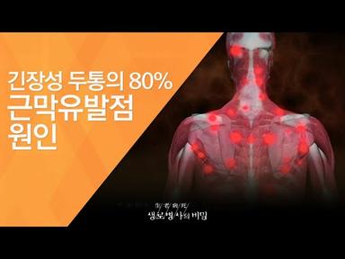 긴장성 두통의 80% 근막유발점 원인 - (20120526_414회 방송)_인체의 사이렌, 통증 2편 - 두통